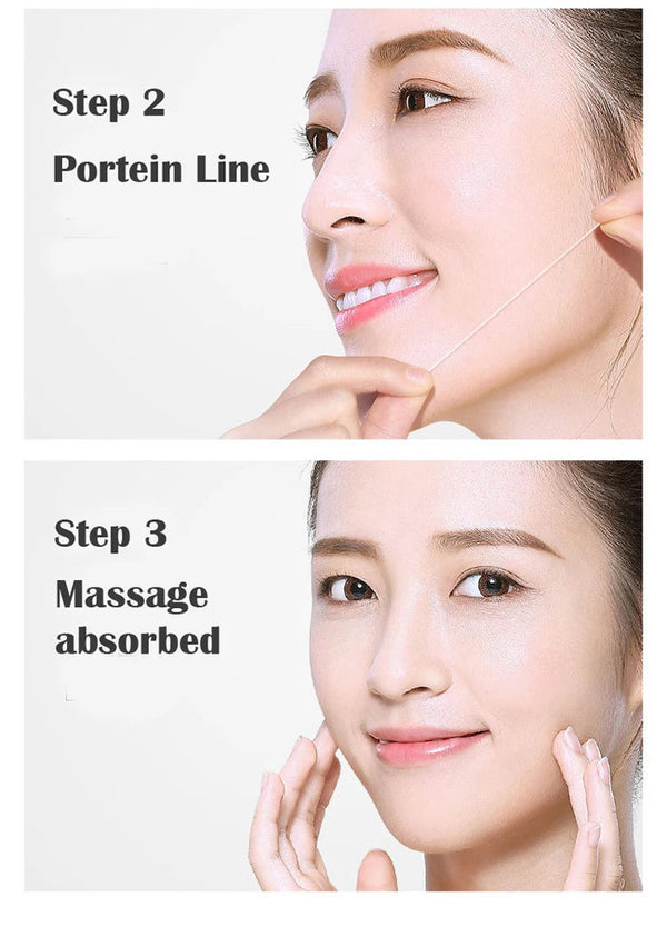 Face Filler Absorbable Collagen Protein Thread Face Lift Plump Silk Fibroin Line Carving Anti Aging Essence NoirKiss